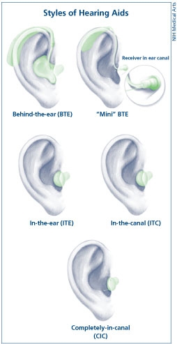 Styles of hearing aids